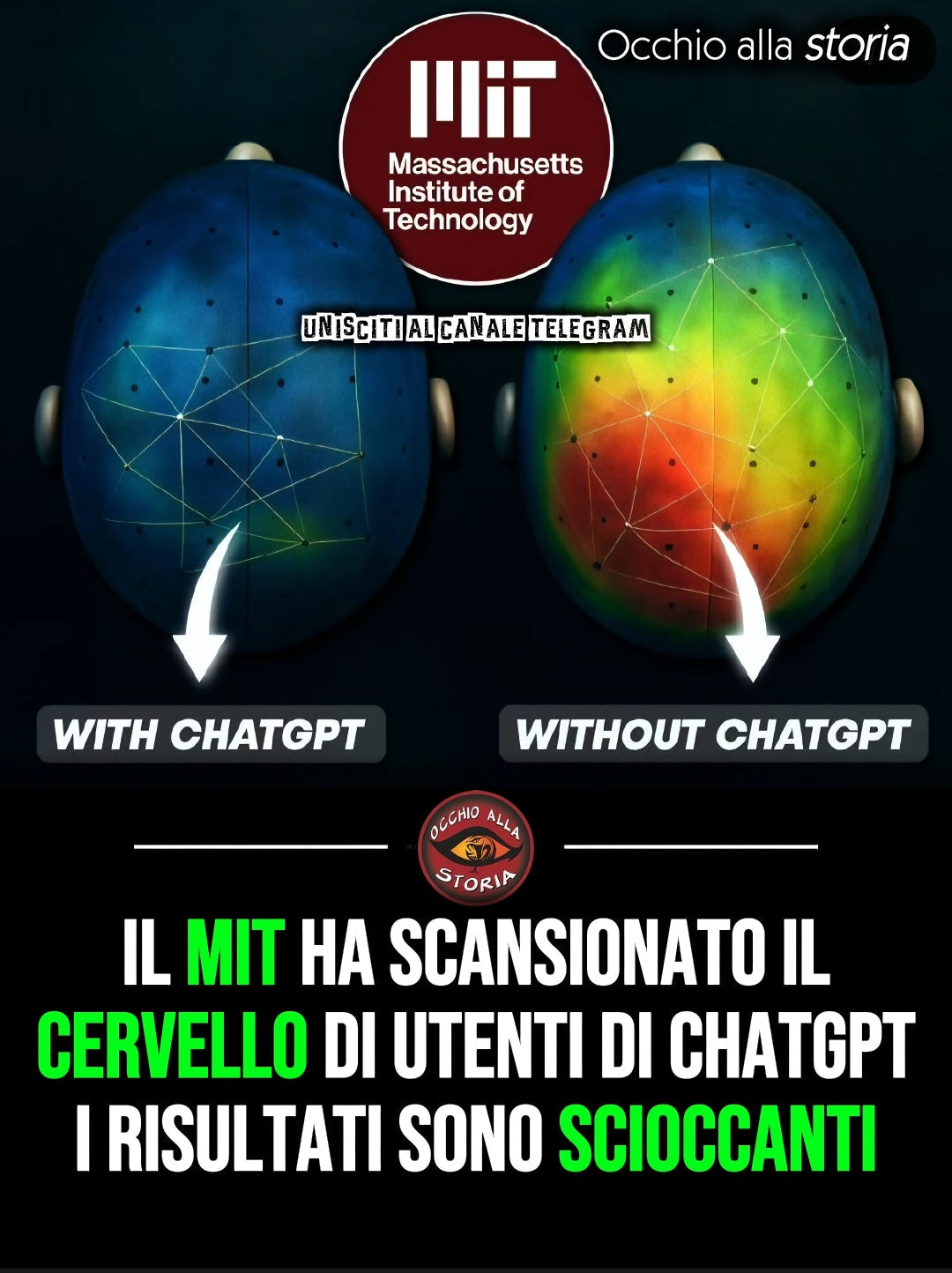MIT: CHATGPT DIMEZZA LA CONNETTIVITÀ CEREBRALE. È ALLARME COGNITIVO